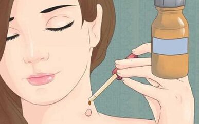 Como desfacerse dos remedios populares de papilomas