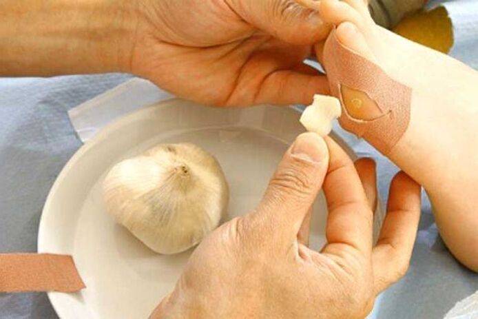 Tratamento do papiloma con compresión de allo